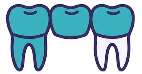 Dental Bridge Icon