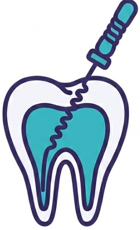 Root Canal Icon